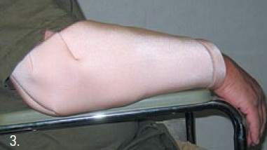 DermaSaver Arm-Bow